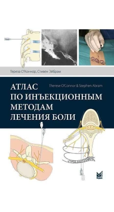 Атлас по инъекционным методам лечения боли. 2-е изд.. С. Э. Эйбрам