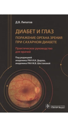 Диабет и глаз. Поражение органа зрения при сахарном диабете. Д. В. Липатов