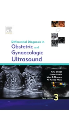 Differential Diagnosis in Obstetrics and Gynecologic Ultrasound. RAL Bisset