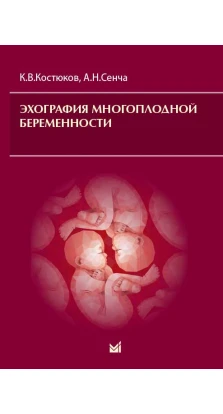 Эхография многоплодной беременности. К. В. Костюков