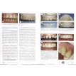 Эстетическая стоматология. Фото 2