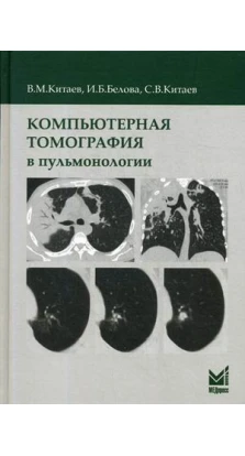 Компьютерная томография в пульмонологии. 2-е изд.. В. М. Китаев. С. В. Китаев