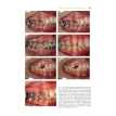 Лазеры в стоматологии:клиническое руководство. Акира Аоки. Лусиана Алмейда-Лопес. Лучио Фриго. Фото 13