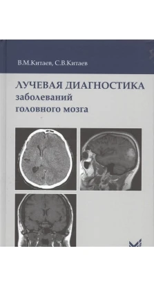 Лучевая диагностика заболеваний головного мозга. В. М. Китаев. С. В. Китаев