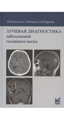 Лучевая диагностика заболеваний головного мозга. В. М. Китаев. С. В. Китаев. О. Ю. Б