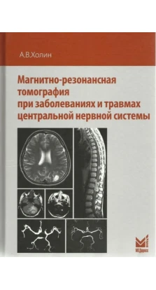 Магнитно-резонансная томография при заболеваниях и травмах центральной нервной системы. Александр Васильевич Холин