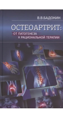 Остеоартрит: от патогенеза к рациональной терапии. Владимир Васильевич Бадокин