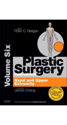 Plastic Surgery, Volume 6: Hand and Upper Limb (Expert Consult - Online and Print). Peter C. Neligan