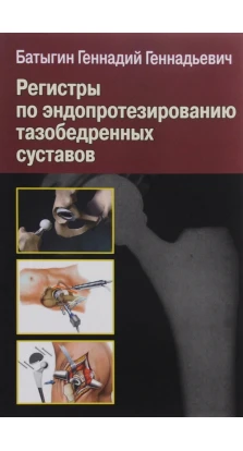 Регистры по эндопротезированию тазобедренных суставов. Геннадий Геннадьевич Батыгин