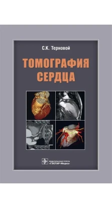 Томография сердца. Сергей Терновой