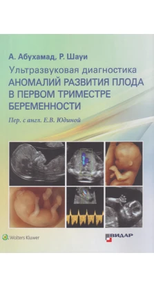 Ультразвуковая диагностика аномалий развития плода в первом триместре беременности. А. Абухамад. Р. Шауи